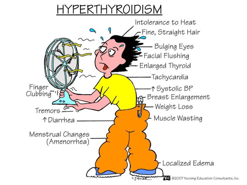 hyperthyroidism