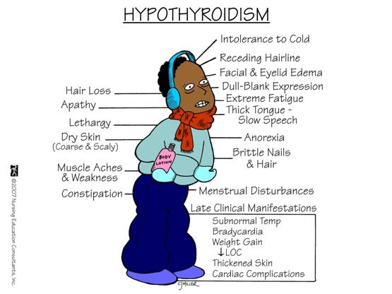 hypothyroidism